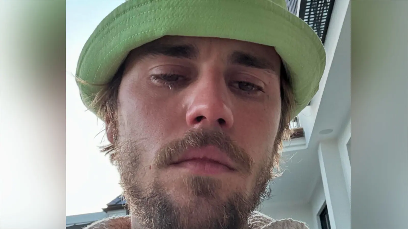Des photos troublantes de Justin Bieber font surface